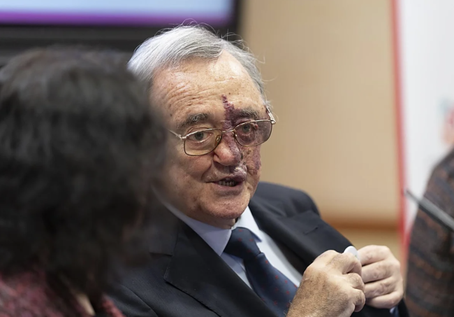 Ξεκίνησε εκστρατεία συγκέντρωσης κεφαλαίων για την υποστήριξη της ισπανικής ανακάλυψης στην έρευνα για τον καρκίνο του παγκρέατος